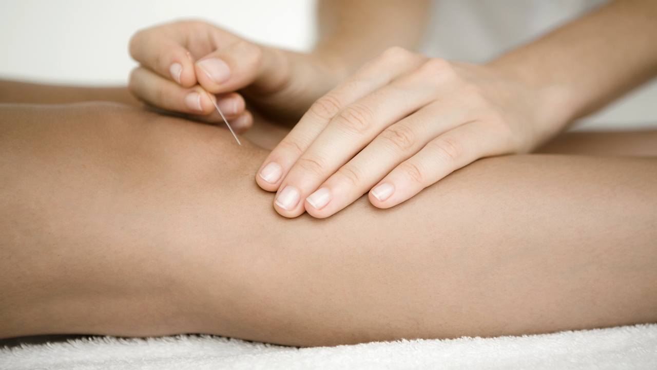 Akupunktur i knæet